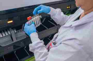  Hemepar passa a fazer testes sorológicos para aumentar segurança em transplantes 